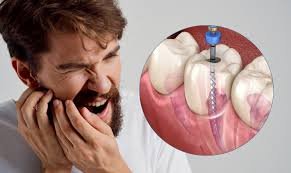 best treatment of root canal